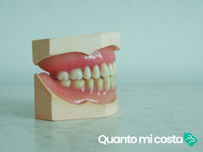 Quanto costa una dentiera?